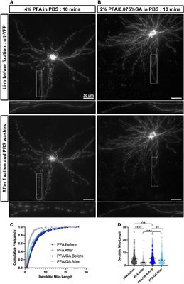 Neuronal mitochondrial morphology is significantly affected by both fixative and oxygen level during perfusion